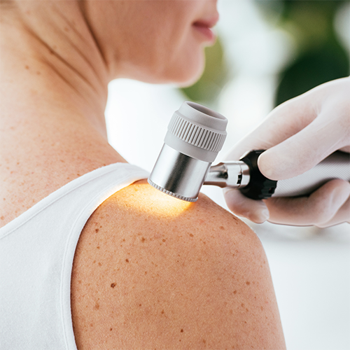 DERMATOLOJİ (CiLDiYE)